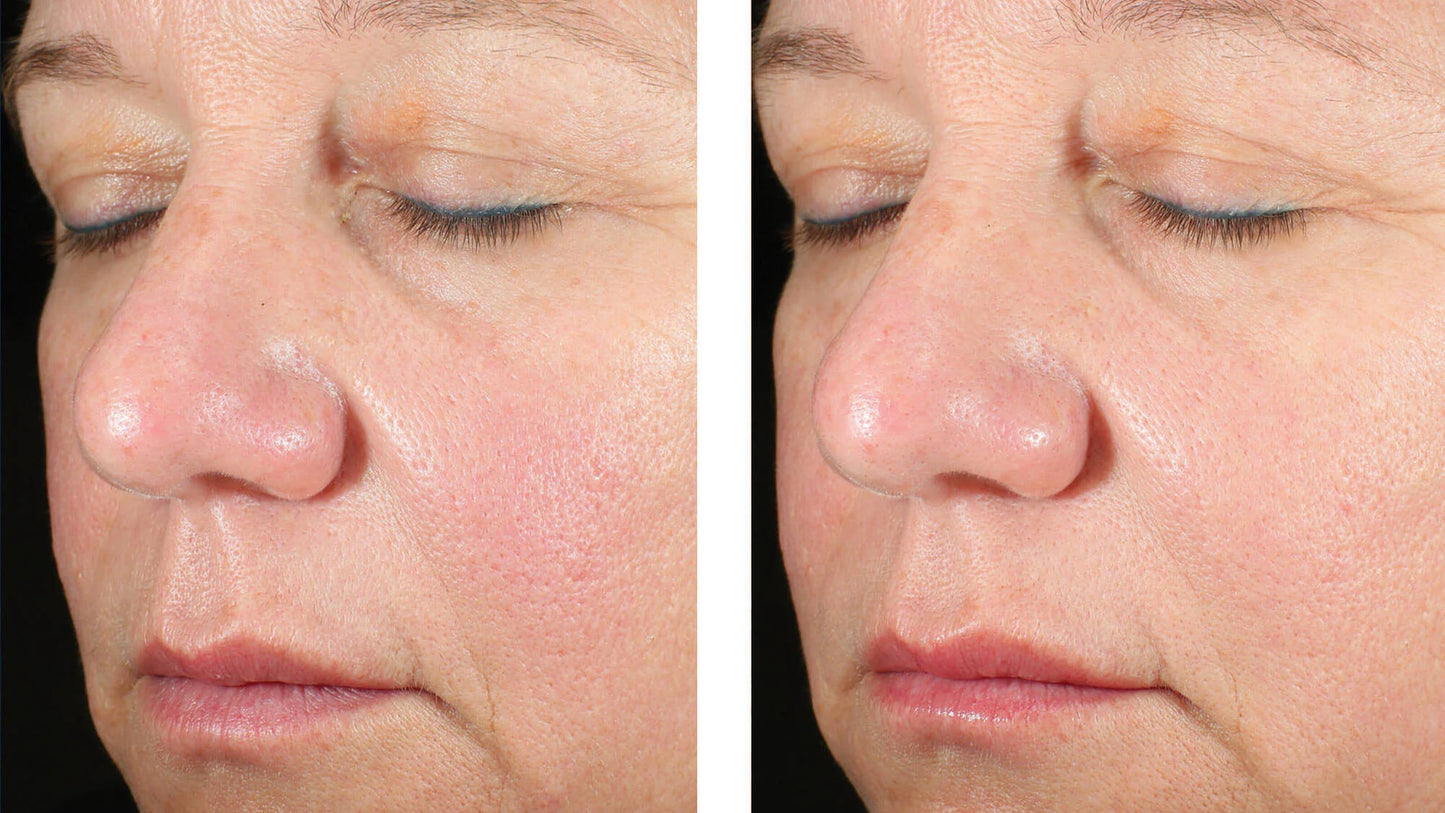 Alto Advanced Defense and Repair Serum