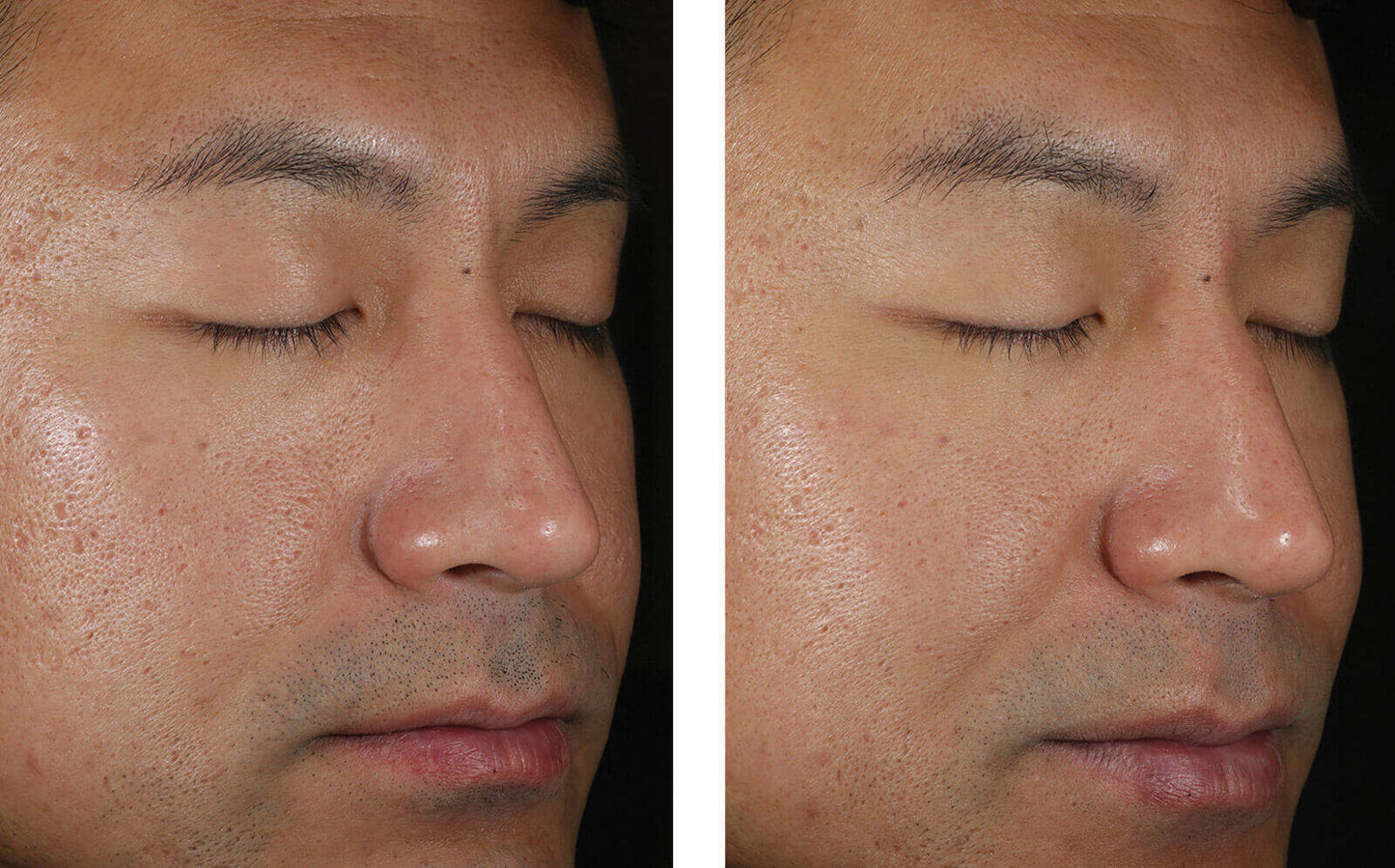 Solo Hydrating Defense for Men