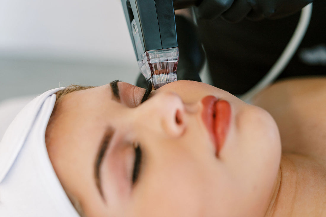 Unlock Clear Skin with Morpheus8 Acne Treatment in Pittsburgh PA!