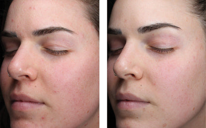 AlphaRet Clearing Serum