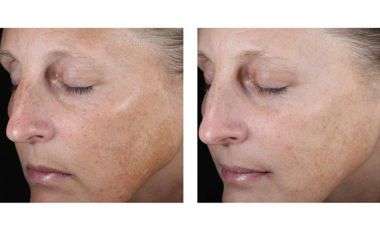 Even Tone Correcting Serum