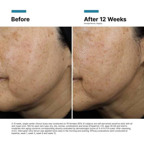 NEW! A.G.E. Interrupter Ultra Serum