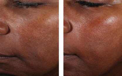 Even Tone Correcting Serum