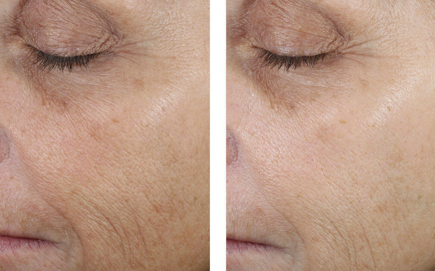 Even Tone Correcting Serum