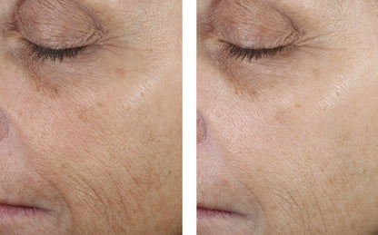 Even Tone Correcting Serum