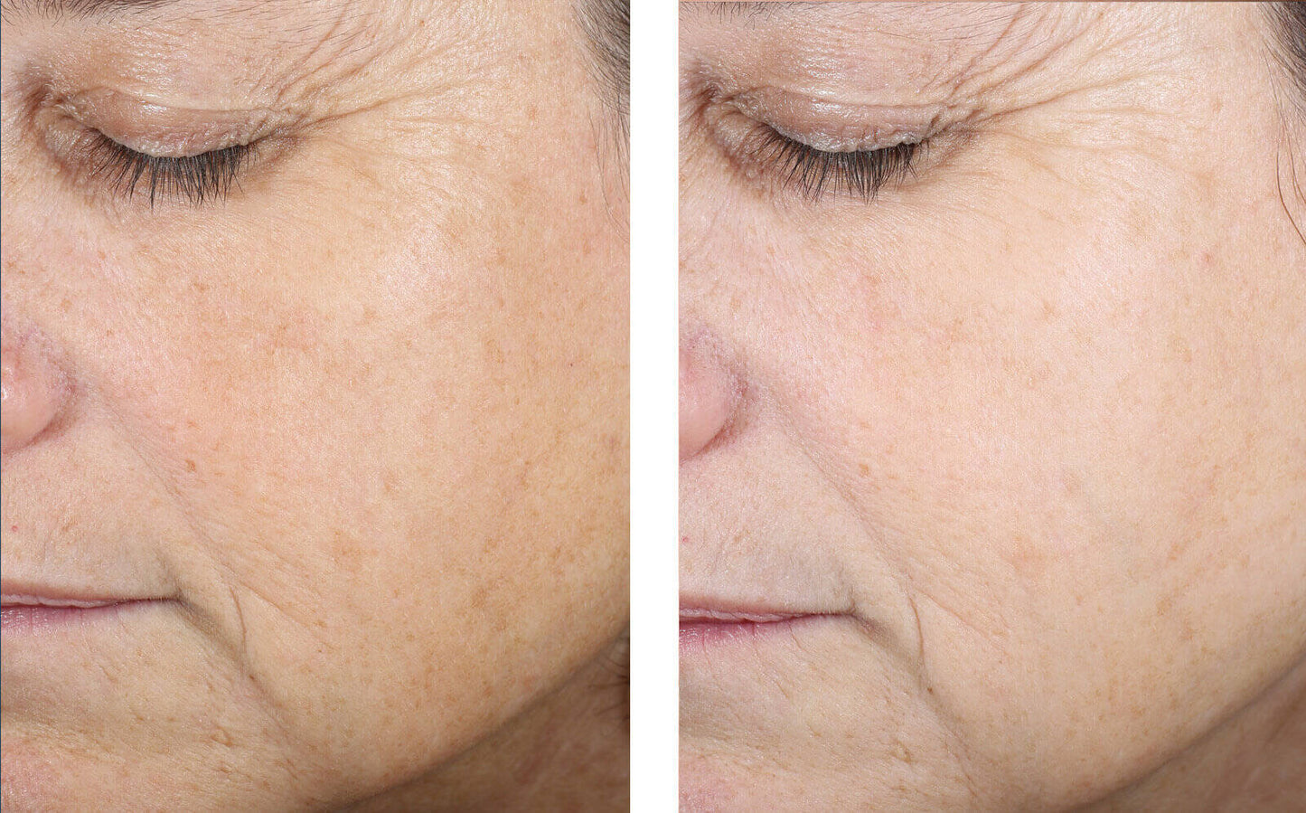 Even Tone Correcting Serum