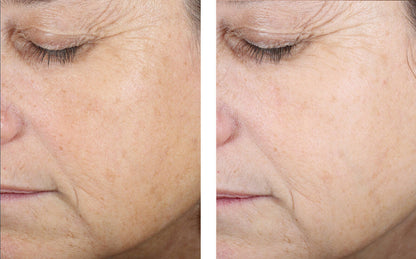 Even Tone Correcting Serum