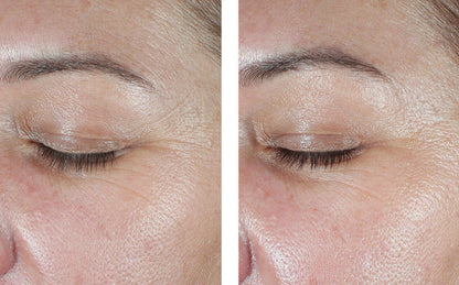 EyeMax AlphaRet Overnight Cream