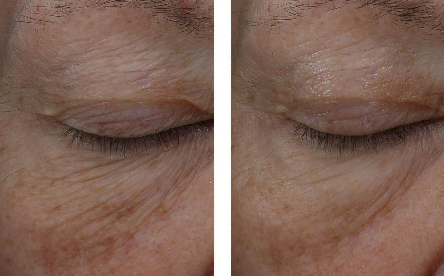 InterFuse Treatment Cream EYE