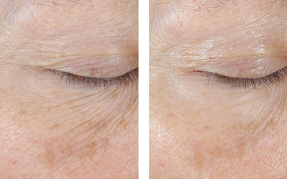 InterFuse Treatment Cream EYE