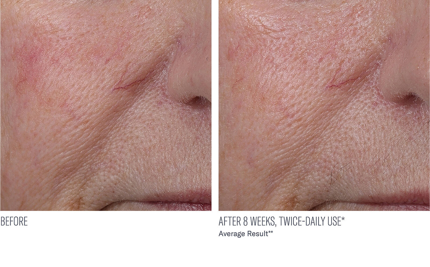 InterFuse Treatment Cream Face + Neck