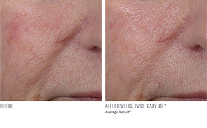 InterFuse Treatment Cream Face + Neck