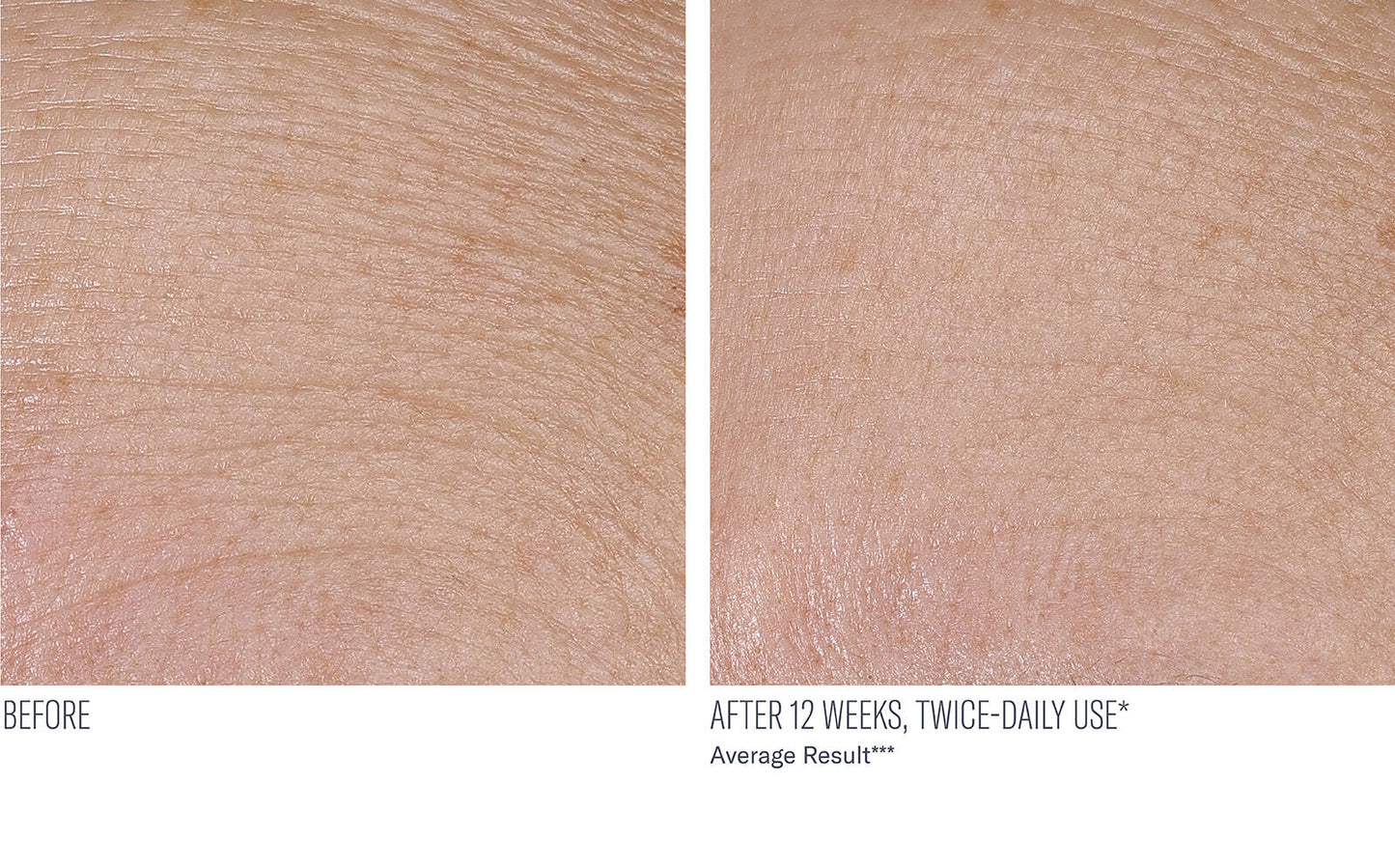 InterFuse Treatment Cream Face + Neck