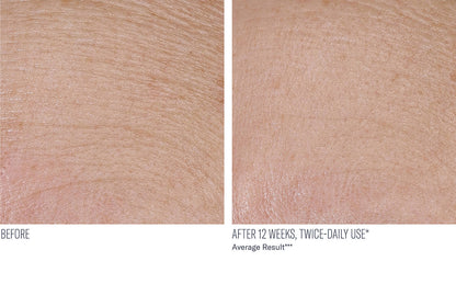 InterFuse Treatment Cream Face + Neck