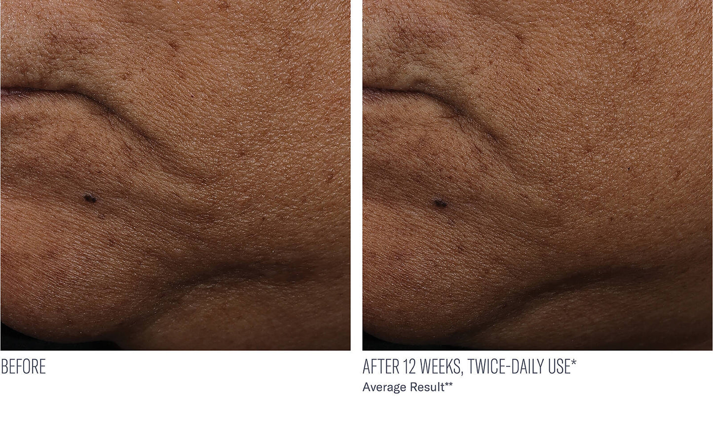 InterFuse Treatment Cream Face + Neck