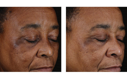 Mystro Active Balance Serum