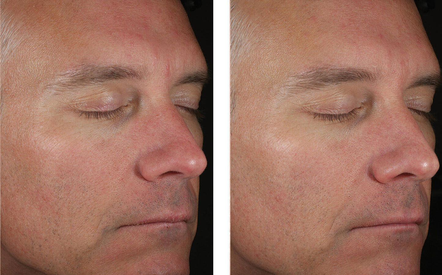 Solo Hydrating Defense for Men