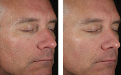 Solo Hydrating Defense for Men