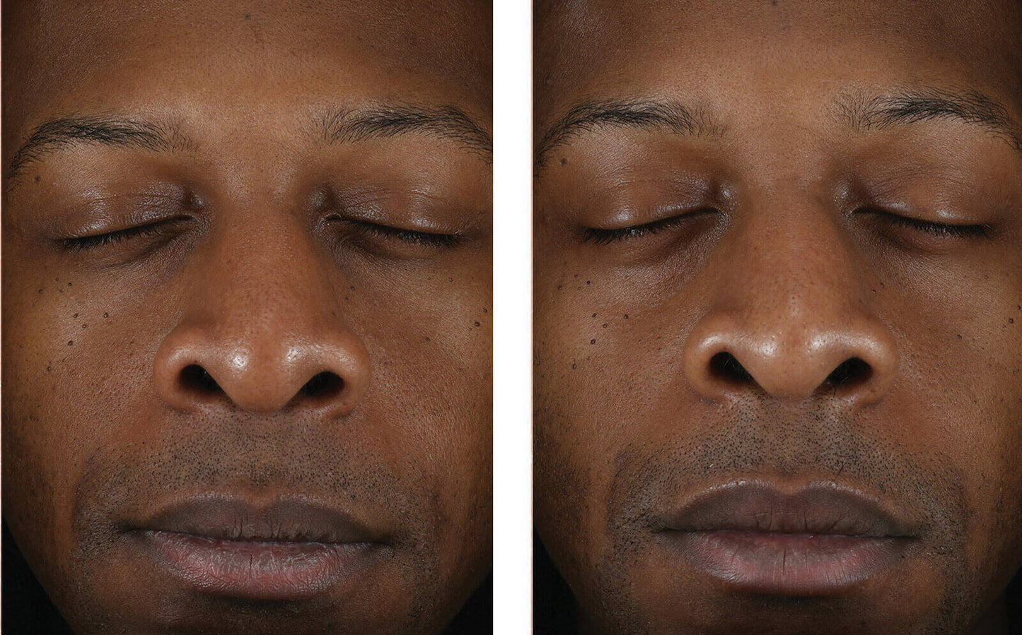 Solo Hydrating Defense for Men