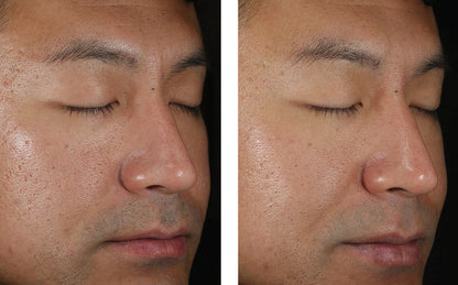 Solo Hydrating Defense for Men