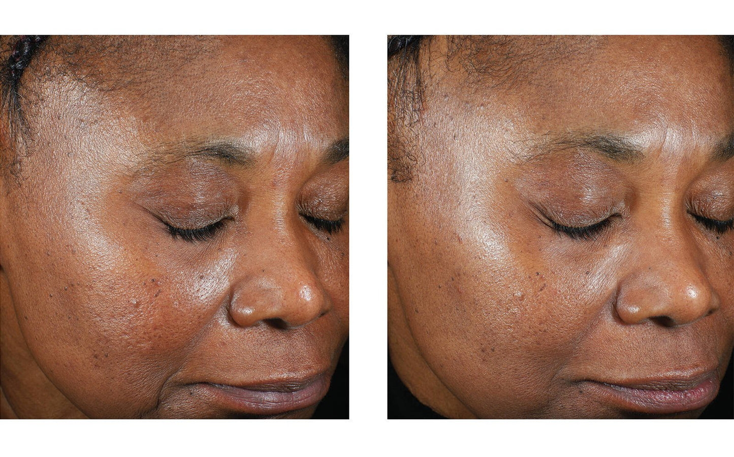 Trio Luxe Moisture Treatment