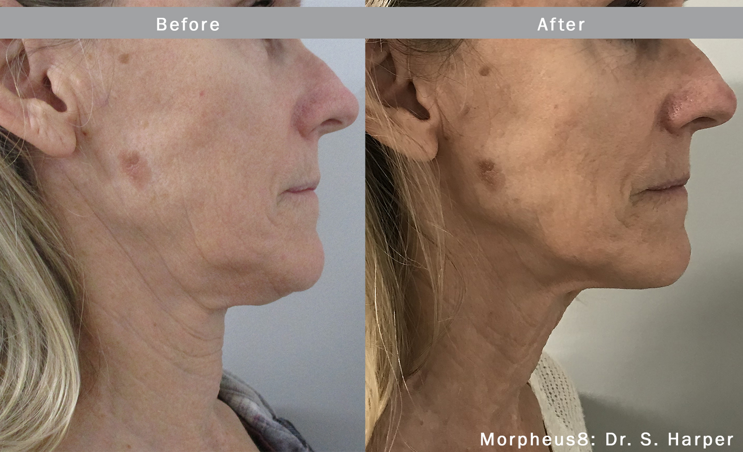 Face, Perioral & Neck Treatment